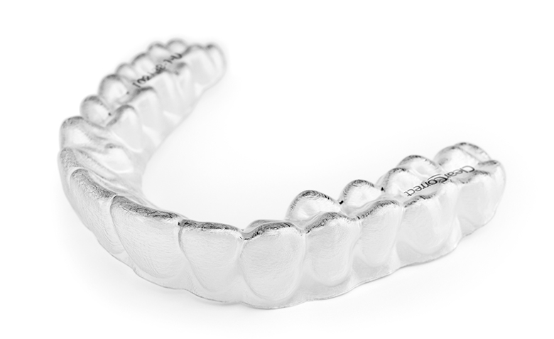 clear aligner